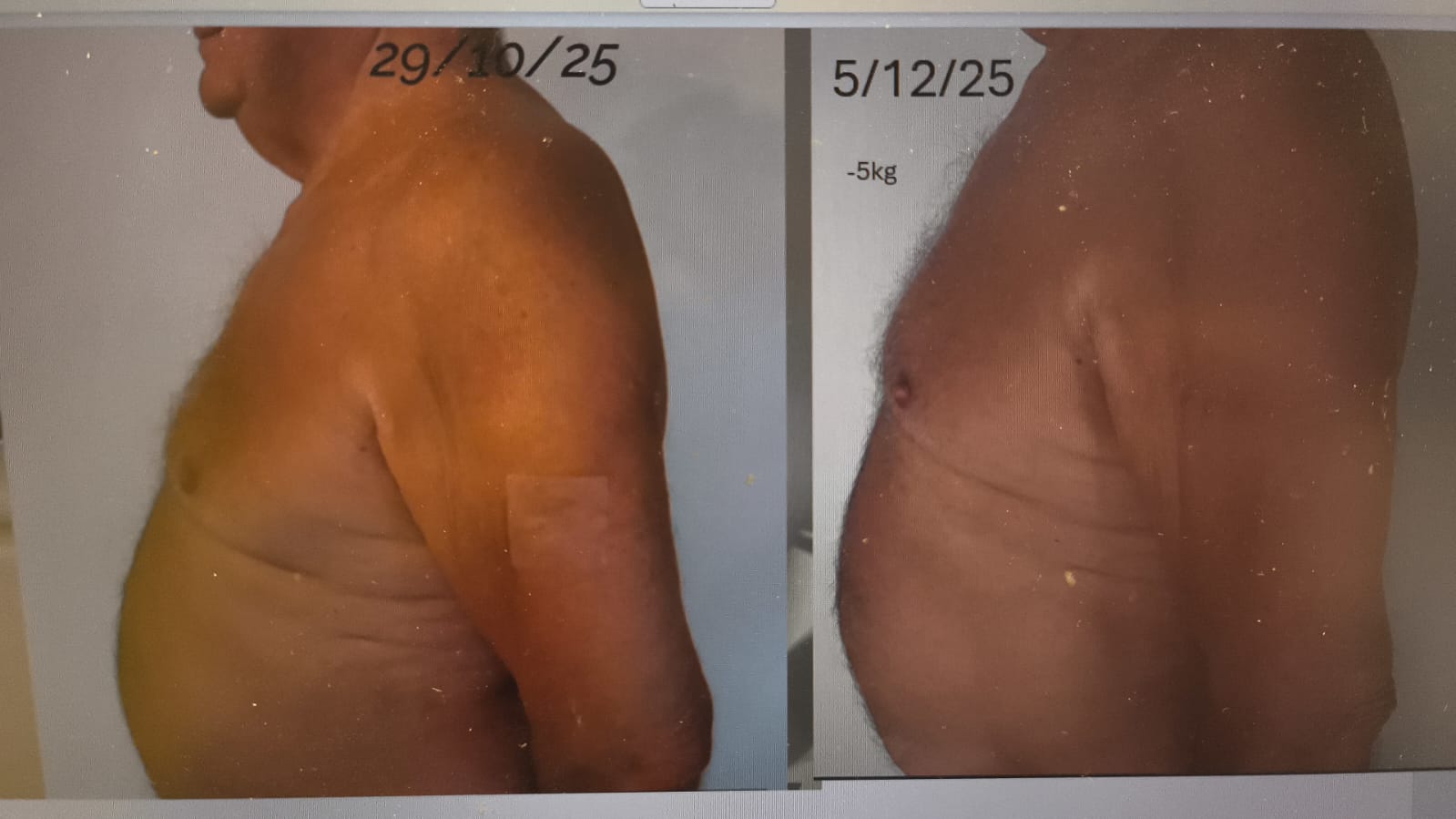 Transformation Feel Great — femme, −5 kg en 3 mois